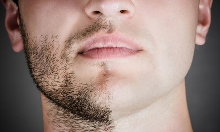 Mitos sobre barba na adolescência 